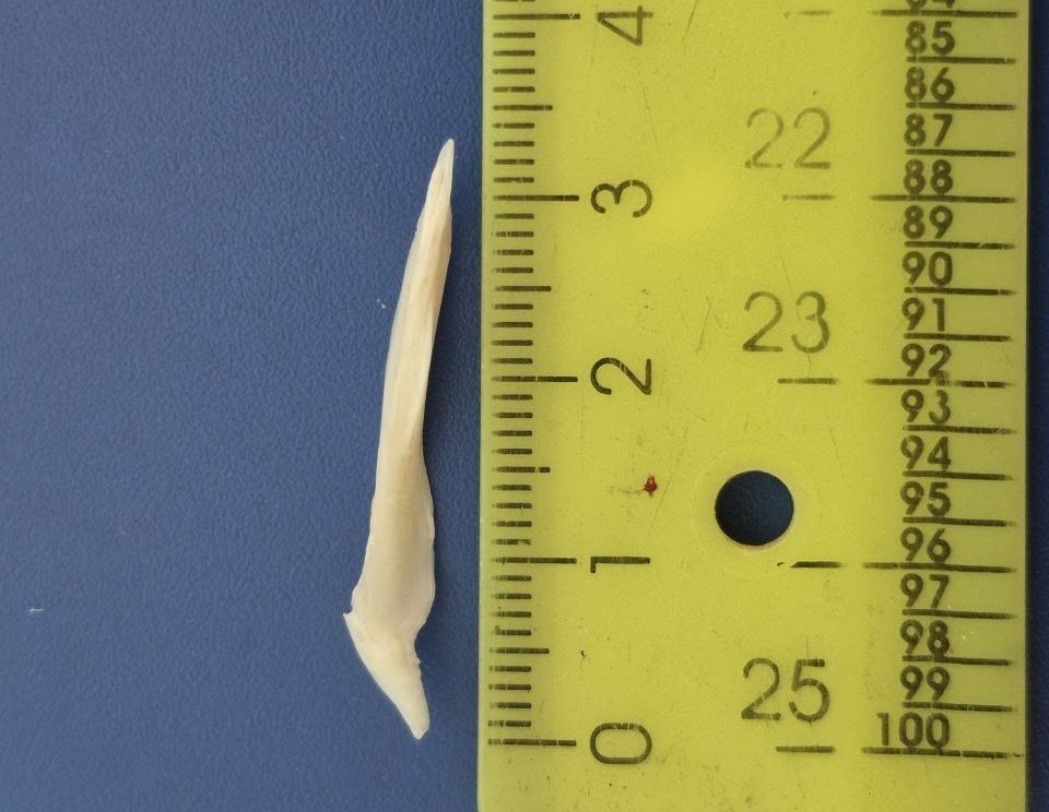 Саратовец проглотил рыбью кость и попал в больницу